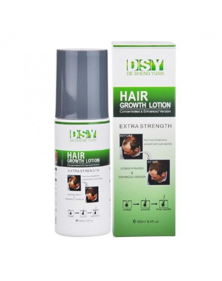 Stop Hair Loss Hair Regrowth Lotion